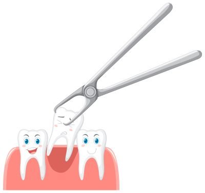 Wisdom Tooth Extraction