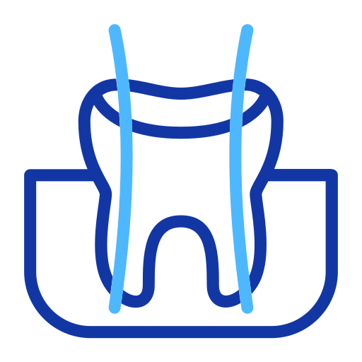 Root Canal